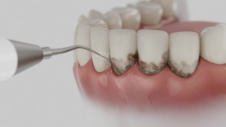 Reliable Emergency Dentist contractor in St. John, KS by Smile Center Dentistry